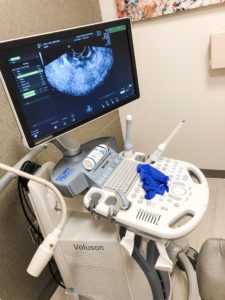 vaginal ultrasound to check follicles for egg donation